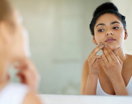 Woman with acne-prone skin looking in a mirror